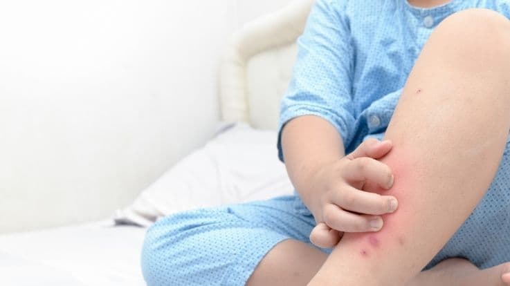 கொசுக்கள் வீட்டில் அடையாமல் இருக்க செக்லிஸ்ட் - என்னென்ன இயற்கை கொசு விரட்டிகள் ?