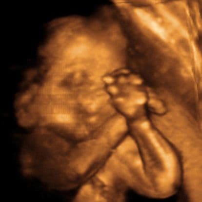 25 weeks and 3 days pregnant