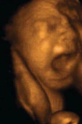 30 weeks and 1 day pregnant