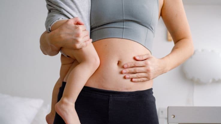 सी-सेक्शन के दर्द को बिना दवाइयों के चुटकियों में कम करने के गुप्त उपाय!