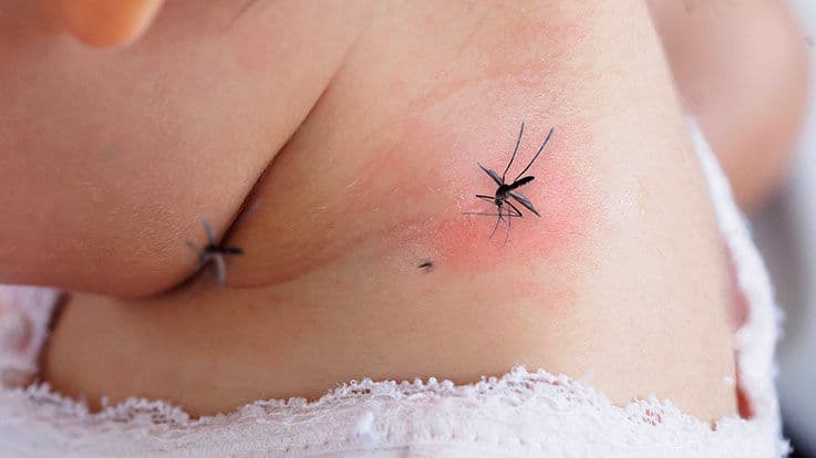 क्या हैं मलेरिया(Malaria) के लक्षण, कारण, उपचार व बचाव के उपाय