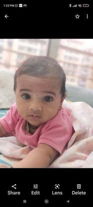White spots on new born babies