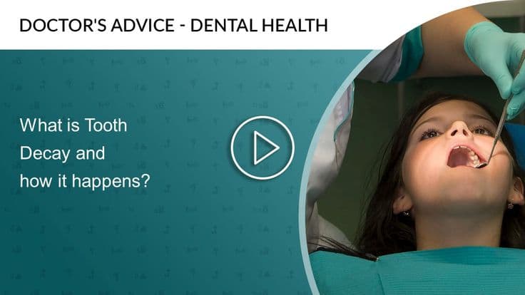 What is Tooth Decay and how it happens
