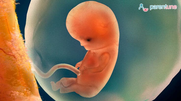 What is Umbilical Hernia? Causes, Who is At Risk & Treatment Remedies