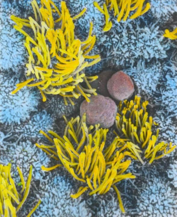 Menstrual Cycle - Week 1 - Day 1