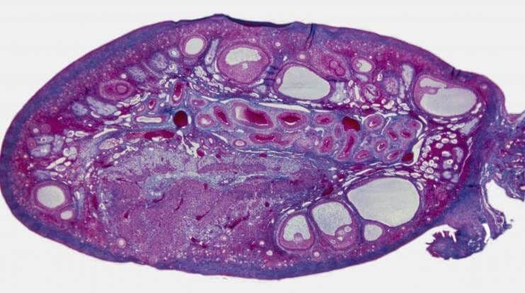 Menstrual Cycle - Week 1 - Day 2