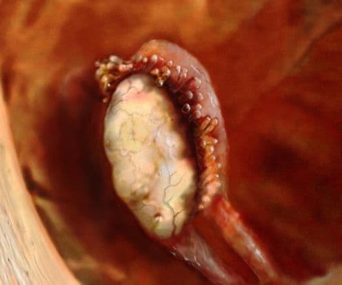 Menstrual Cycle - Week 2 - Day 7