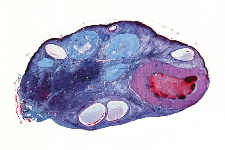 3 weeks and 4 days pregnant