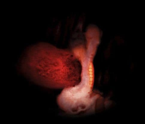 4 weeks and 7 days pregnant