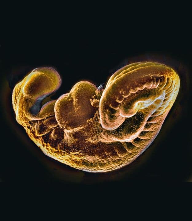 5 weeks and 4 days pregnant