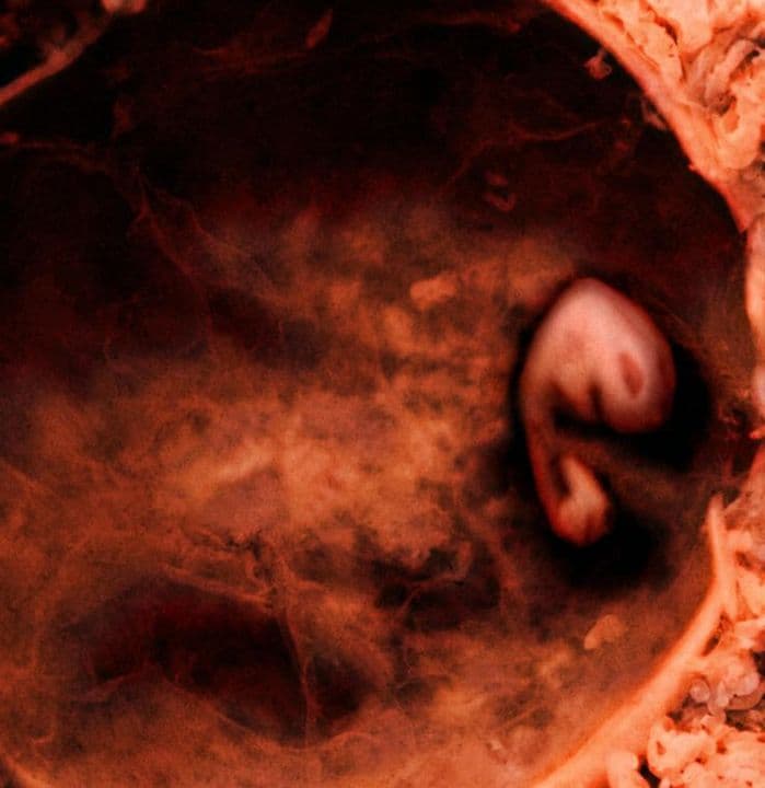 5 weeks and 5 days pregnant