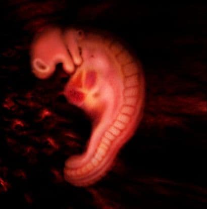 5 weeks and 6 days pregnant