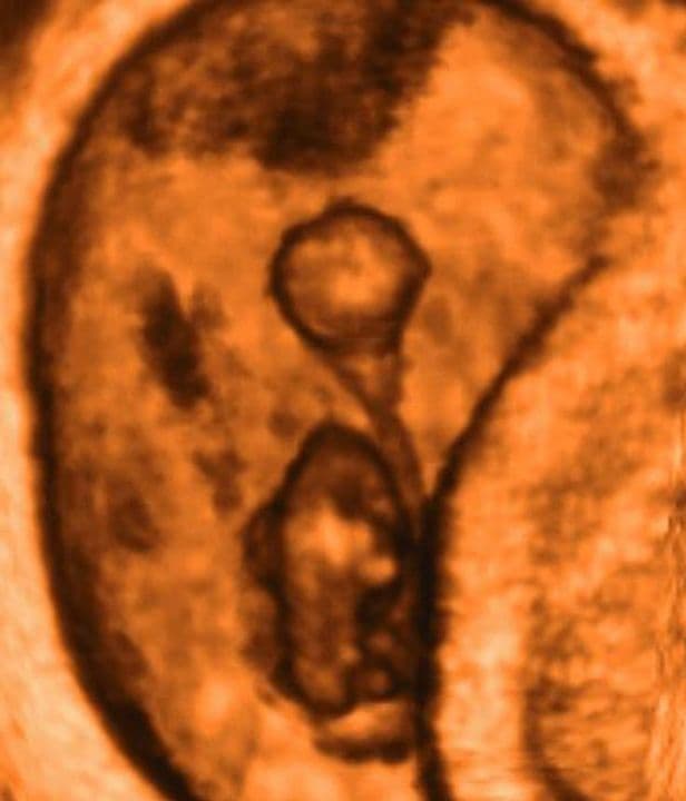 7 weeks and 6 days pregnant