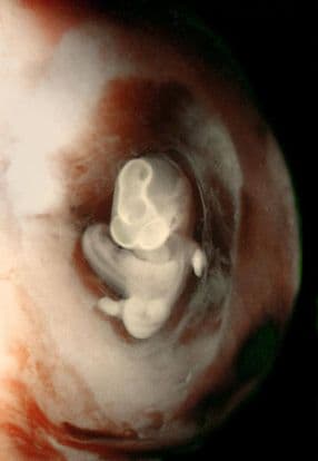 7 weeks and 7 days pregnant