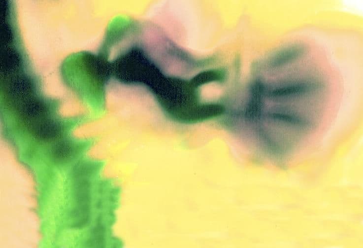 8 weeks and 2 days pregnant