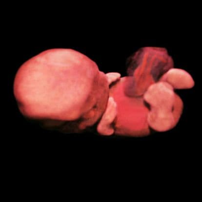 8 weeks and 7 days pregnant