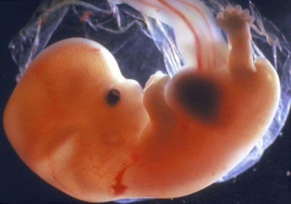 9 weeks and 1 day pregnant