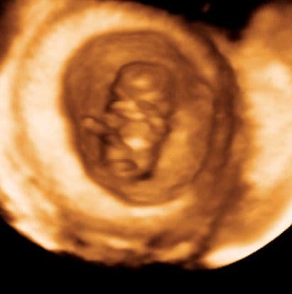 9 weeks and 3 days pregnant