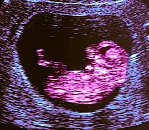 10 weeks and 3 days pregnant