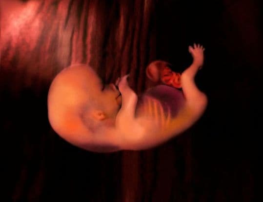 10 weeks and 5 days pregnant