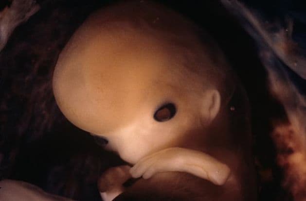 10 weeks and 7 days pregnant