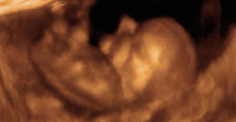 11 weeks and 1 day pregnant