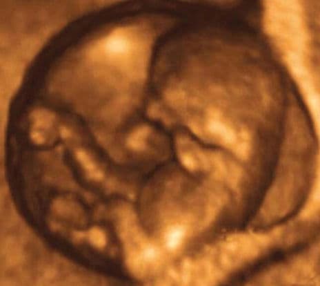 11 weeks and 7 days pregnant
