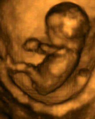 12 weeks and 1 day pregnant