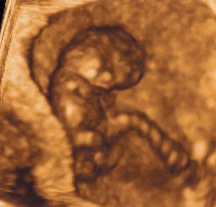 12 weeks and 2 days pregnant