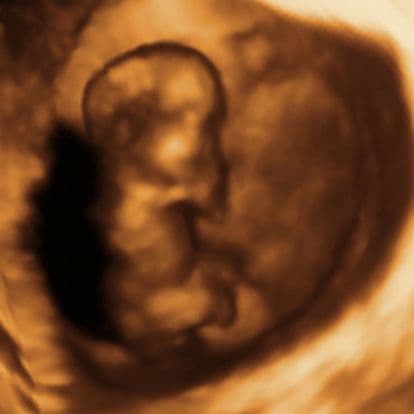 12 weeks and 4 days pregnant