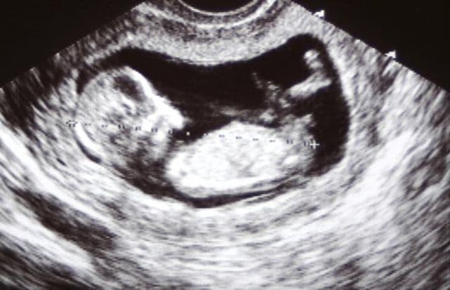 12 weeks and 7 days pregnant