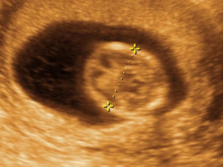 13 weeks and 2 days pregnant