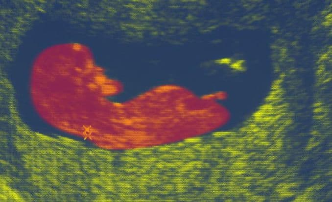 13 weeks and 6 days pregnant