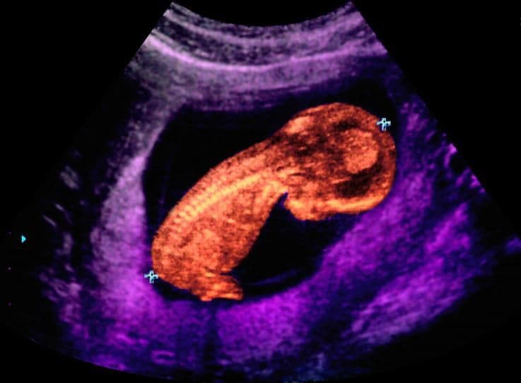 15 weeks and 1 day pregnant