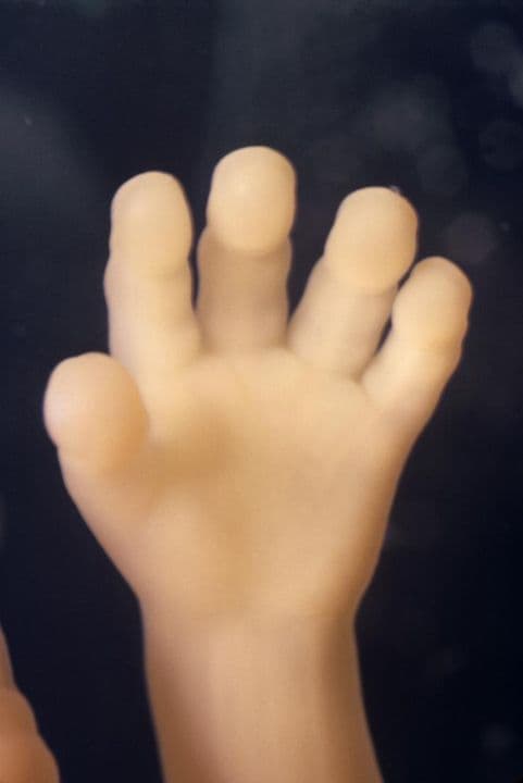 15 weeks and 2 days pregnant