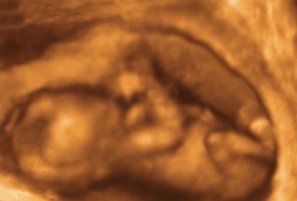15 weeks and 6 days pregnant