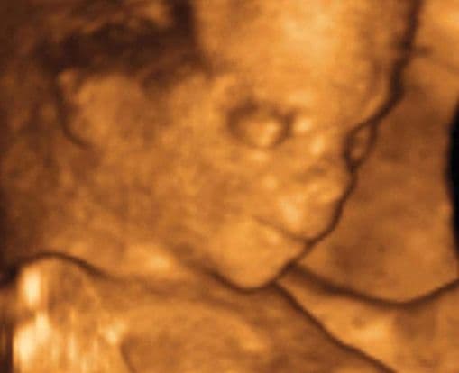 15 weeks and 7 days pregnant