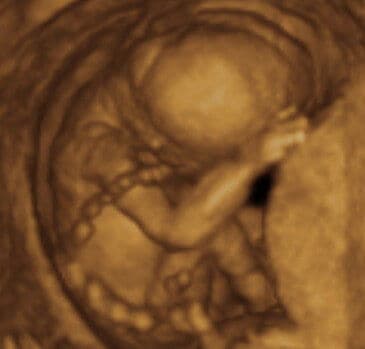 16 weeks and 3 days pregnant