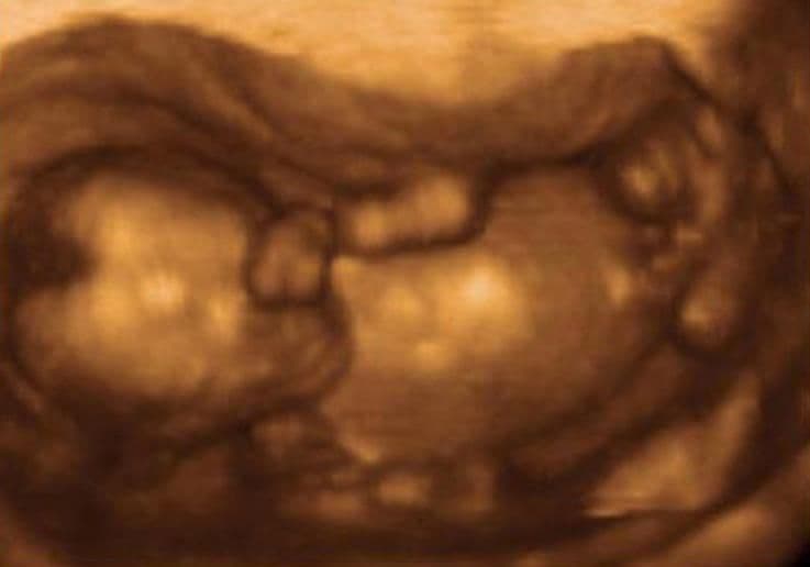 16 weeks and 5 days pregnant