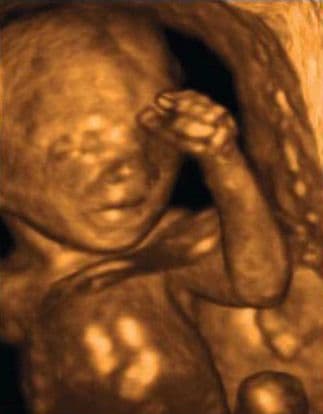 17 weeks and 5 days pregnant