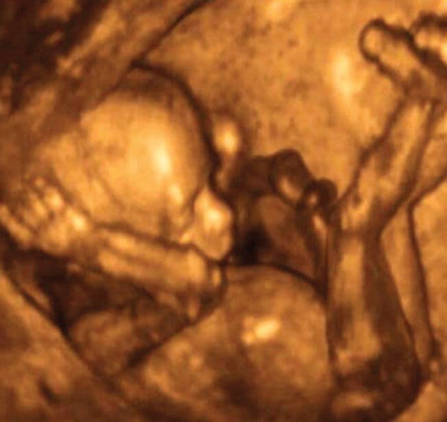 17 weeks and 6 days pregnant