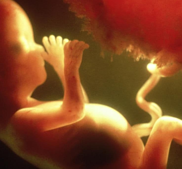 18 weeks and 1 day pregnant