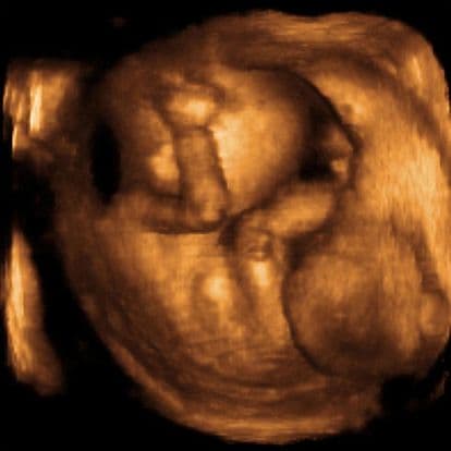18 weeks and 2 days pregnant