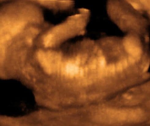 18 weeks and 6 days pregnant