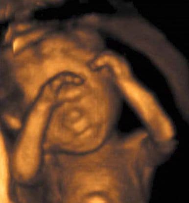 18 weeks and 7 days pregnant