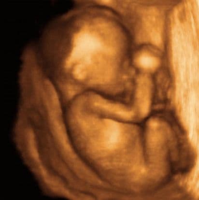 19 weeks and 2 days pregnant