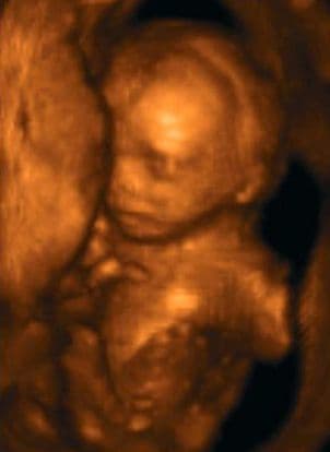 19 weeks and 5 days pregnant