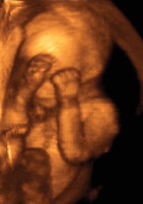 19 weeks and 6 days pregnant