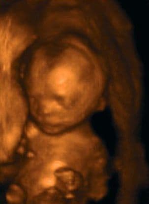 20 weeks and 6 days pregnant