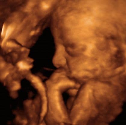 21 weeks and 3 days pregnant